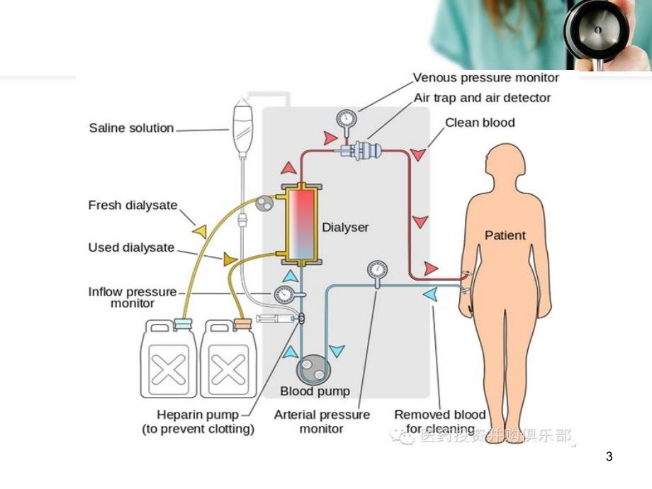 心衰的血液净化治疗ppt参考课件_第3页