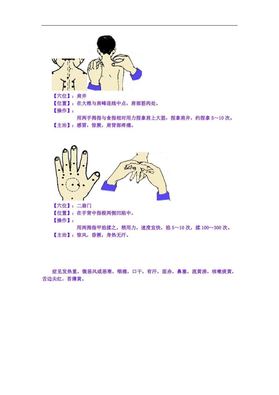 儿童发烧穴位按摩.doc_第5页