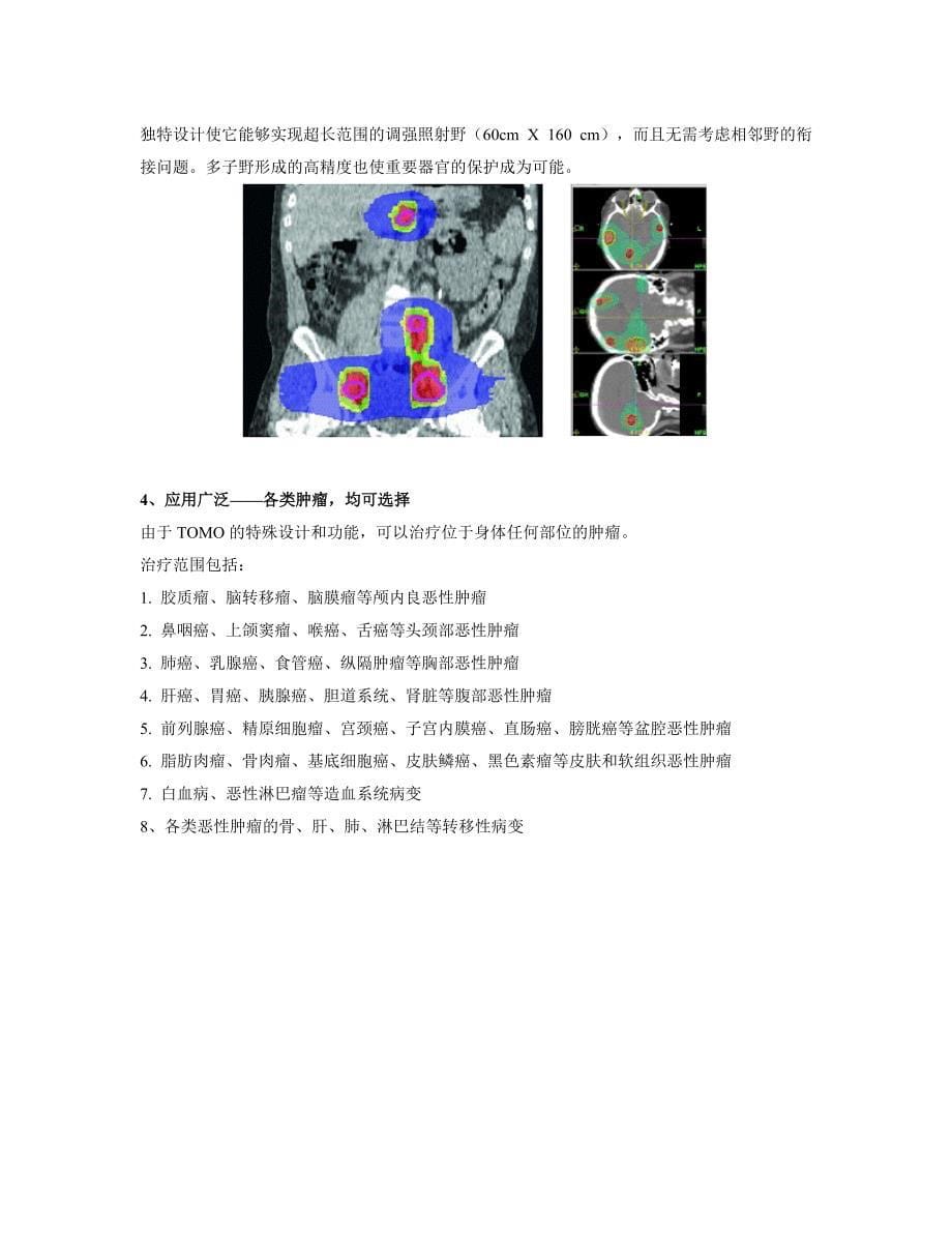 世界最先进的肿瘤放疗设备螺旋断层放射治疗系统.doc_第5页