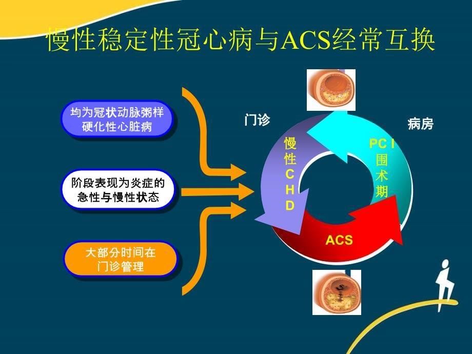 慢性稳定性冠心病长期他汀管理策略_第5页