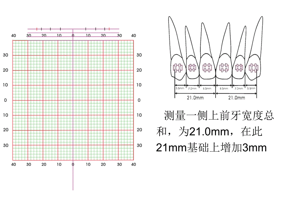 弓丝训练1ppt课件_第2页