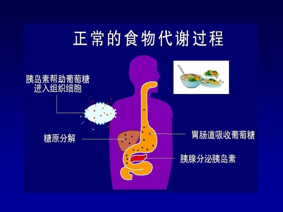 糖尿病饮食管理_第2页