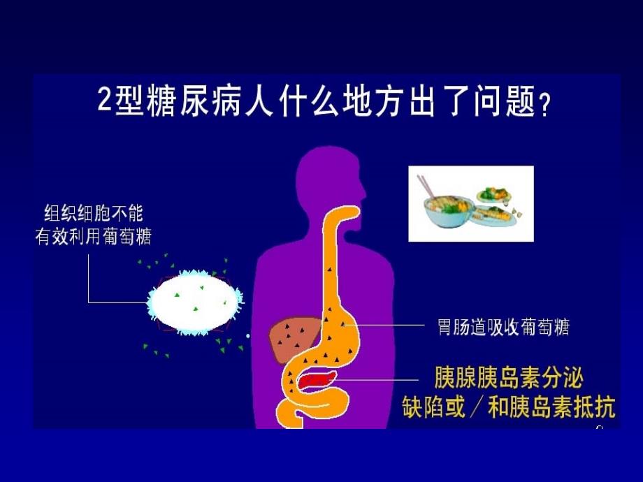 糖尿病饮食管理_第4页