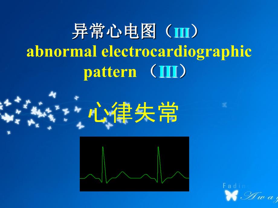 异常心电图心律失常PPT课件_第1页