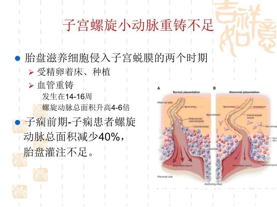 妊娠期高血压疾病全PPT文档_第5页