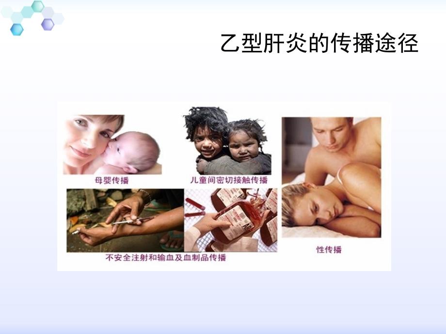 乙型肝炎的母婴传播课件_第3页