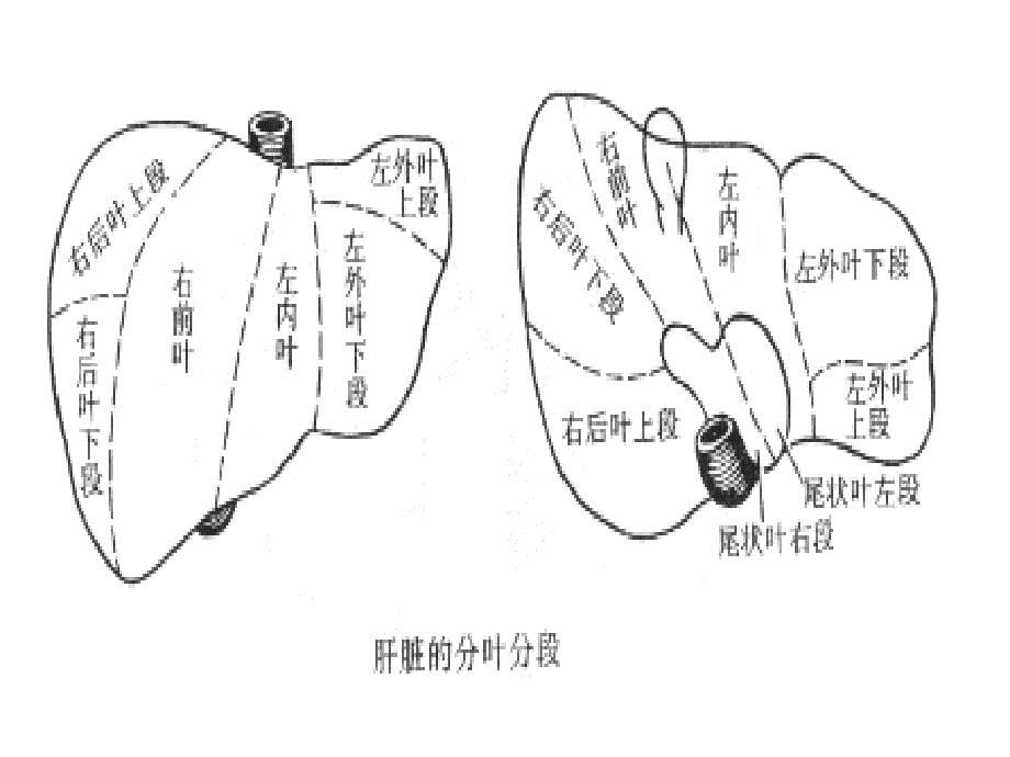 肝脓肿护理进展_第5页