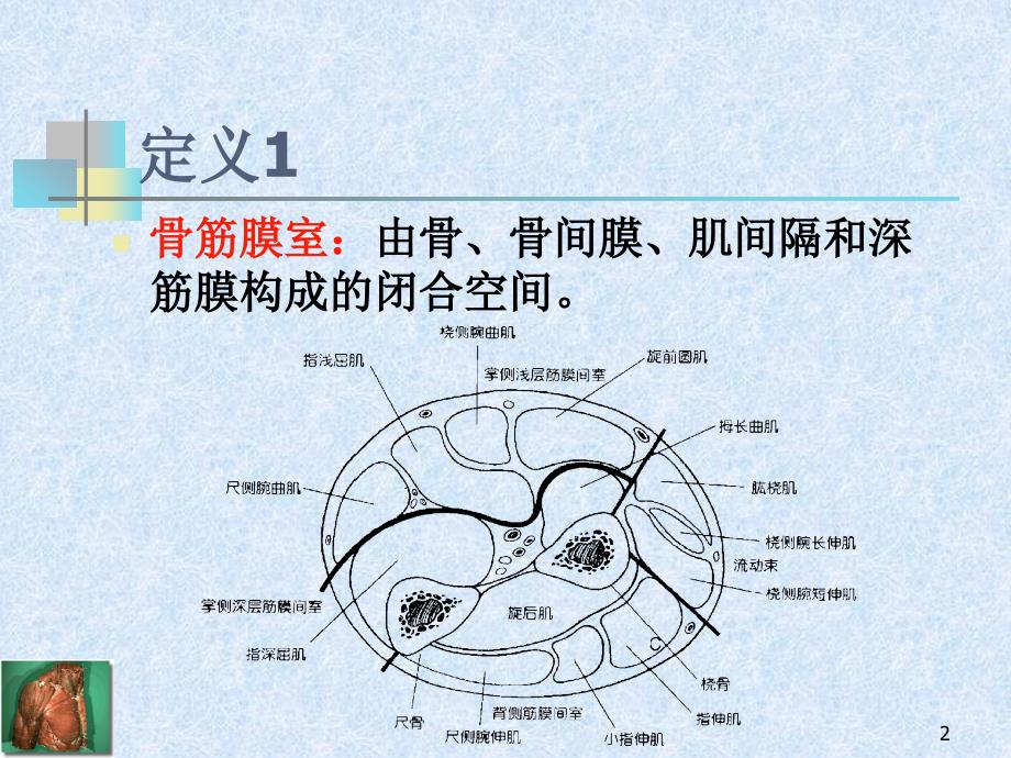 骨筋膜室综合征_第2页