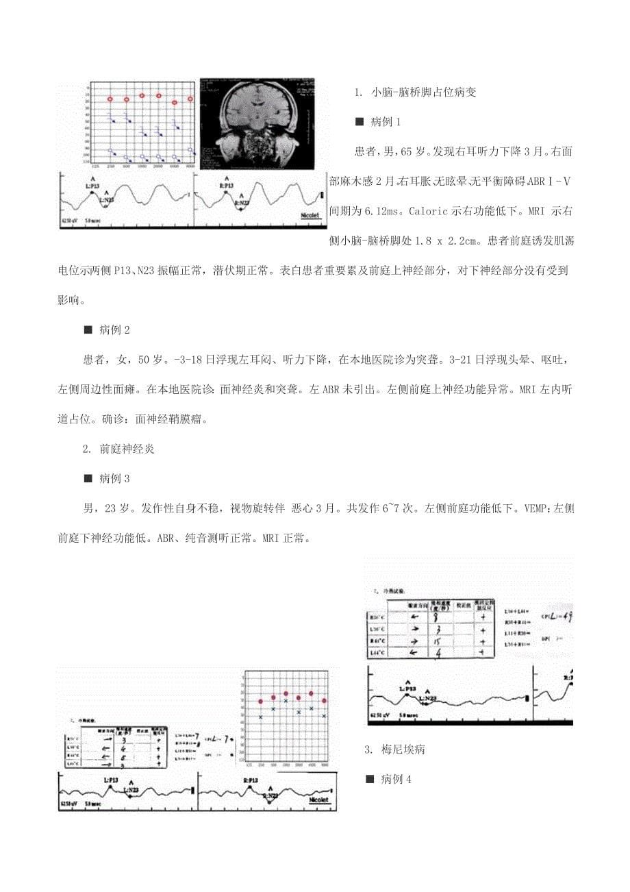 前庭功能临床检查的主要进展_第5页