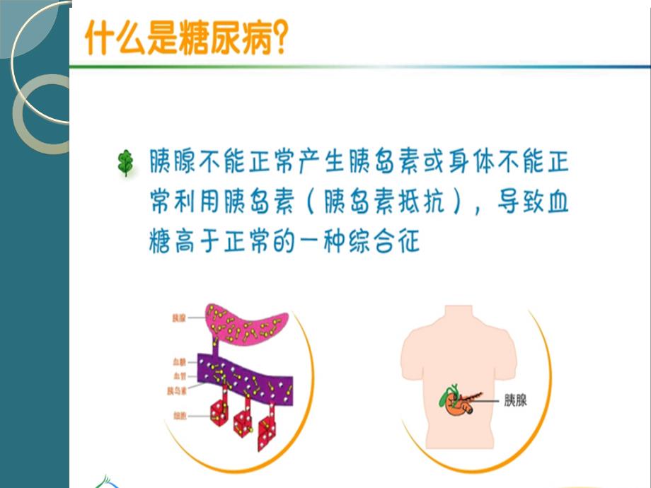 社区型糖尿病患者健康管理规范精英版演示ppt课件_第4页