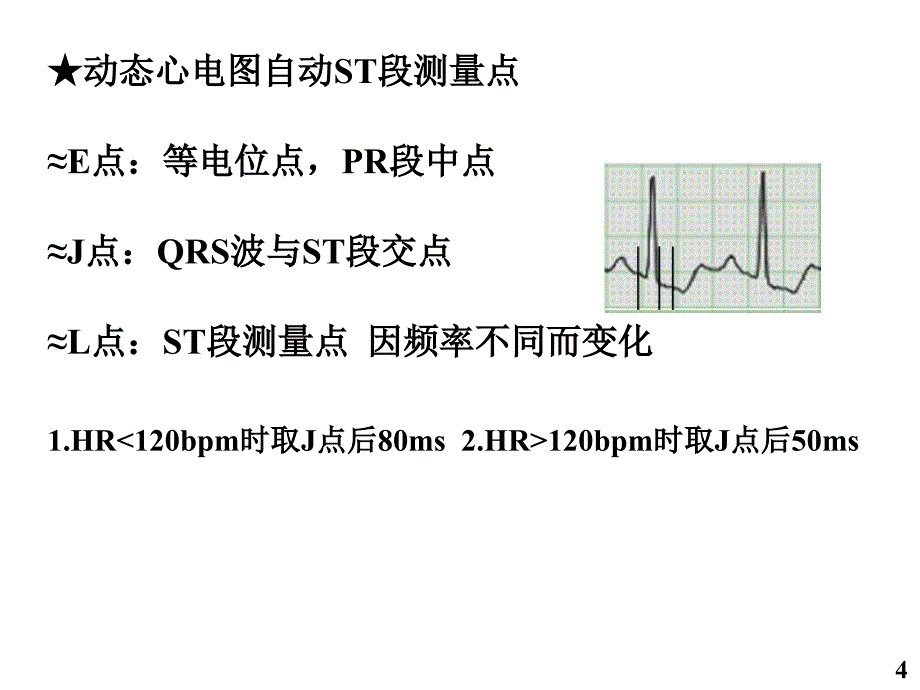 缺血性胸痛时的动态心电图表现_徐金义_第4页