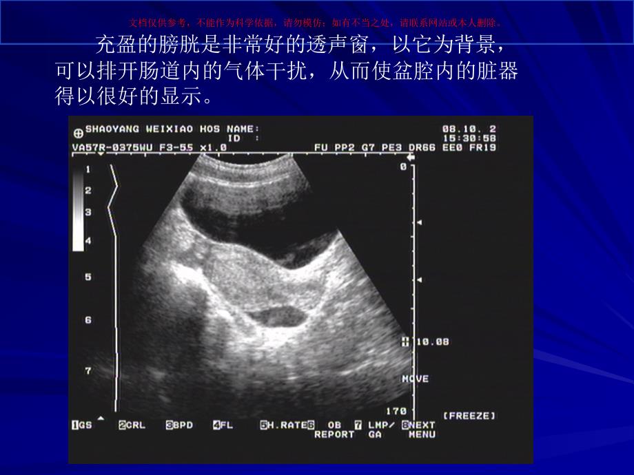 临床超声诊断基础培训课件_第4页