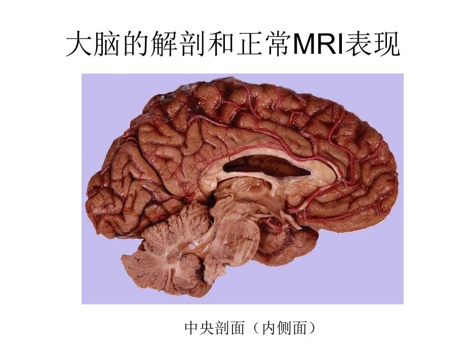 大脑的解剖和正常mri表现_第3页