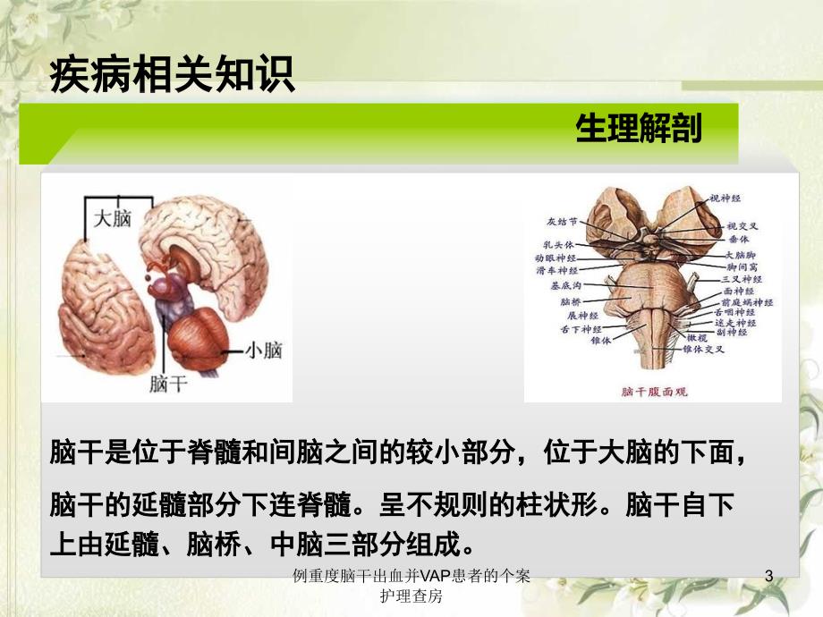 例重度脑干出血并VAP患者的个案护理查房课件_第3页