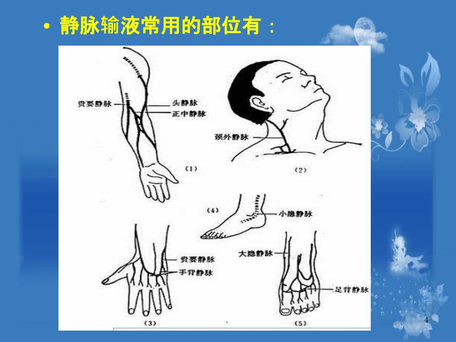 静脉治疗PPT课件1_第4页