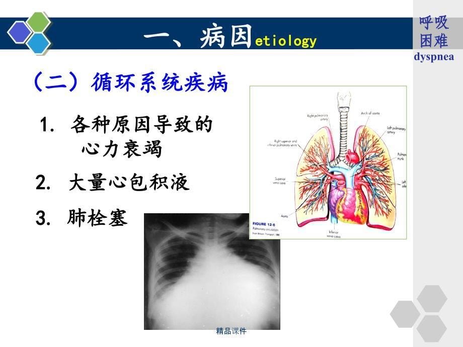 呼吸困难的护理课件_第5页