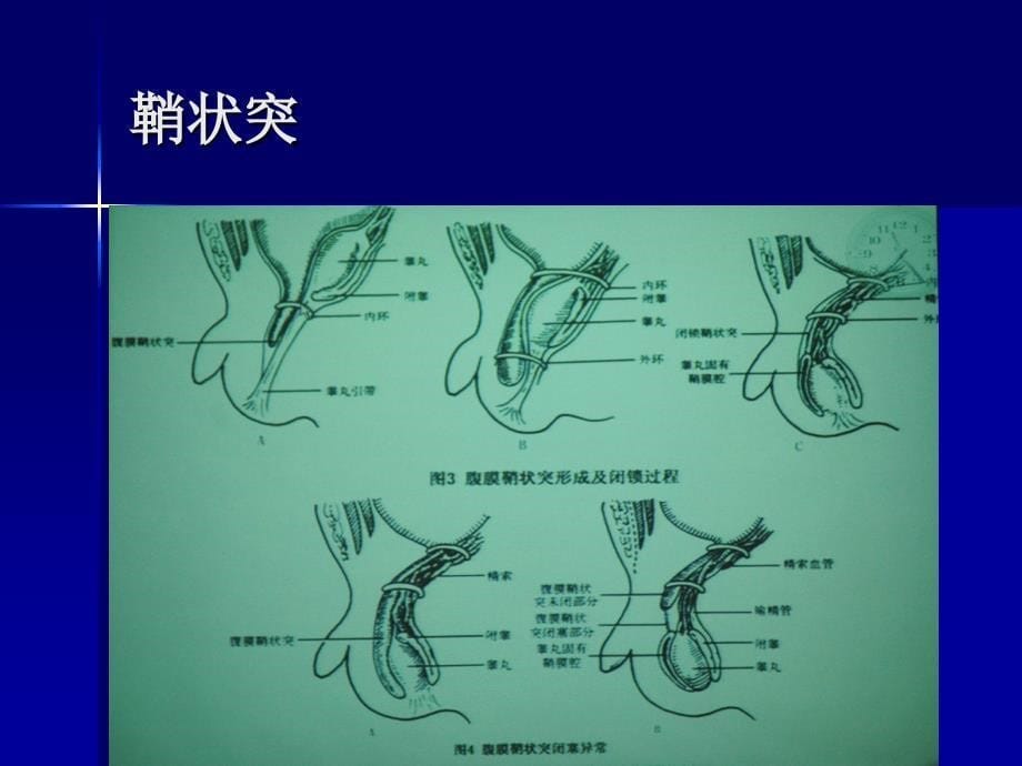 第十章阴囊及其内容物的超声诊断_第5页