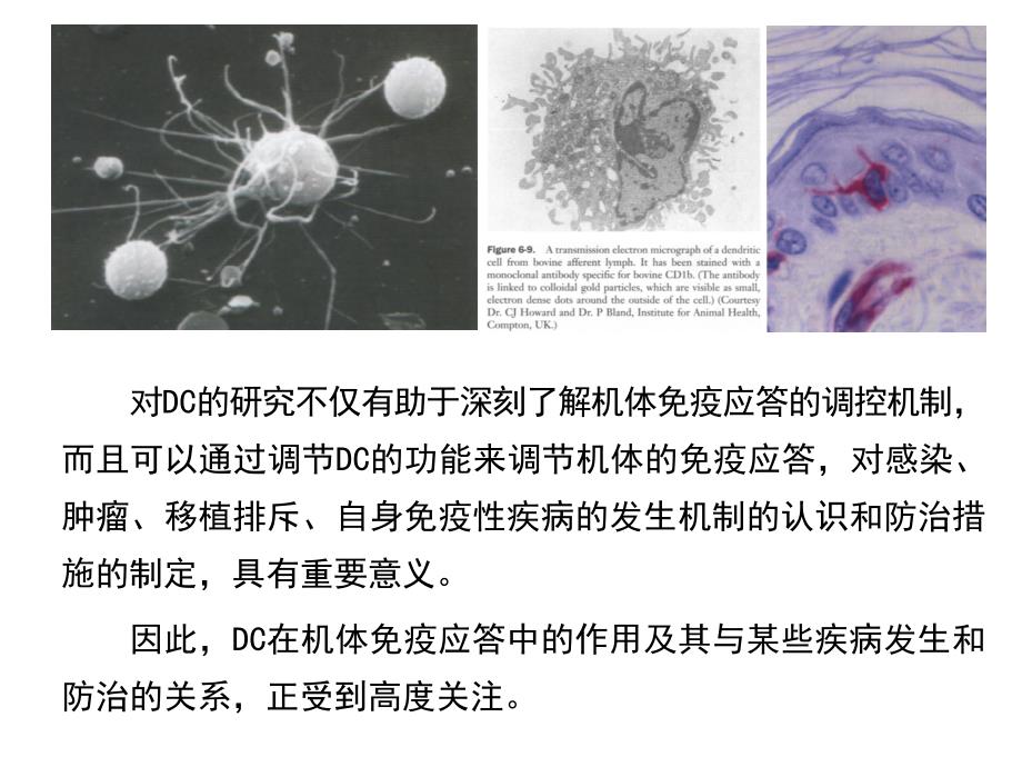 医学专题：树突状细胞简介_第3页