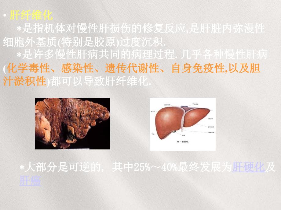 《临床2章肝纤维化的分子生物学》课件_第2页