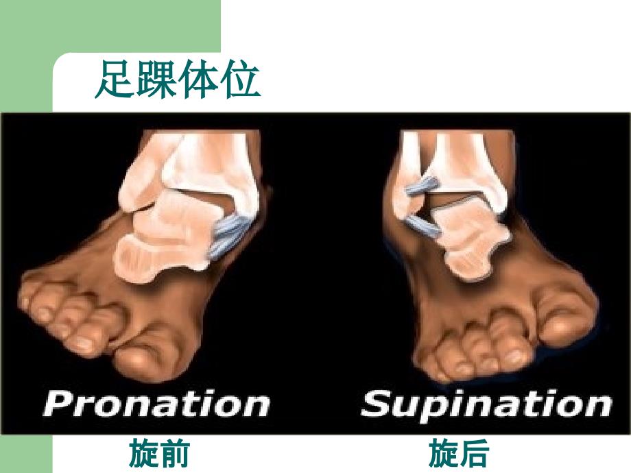 踝关节骨折与脱位的诊治_第3页