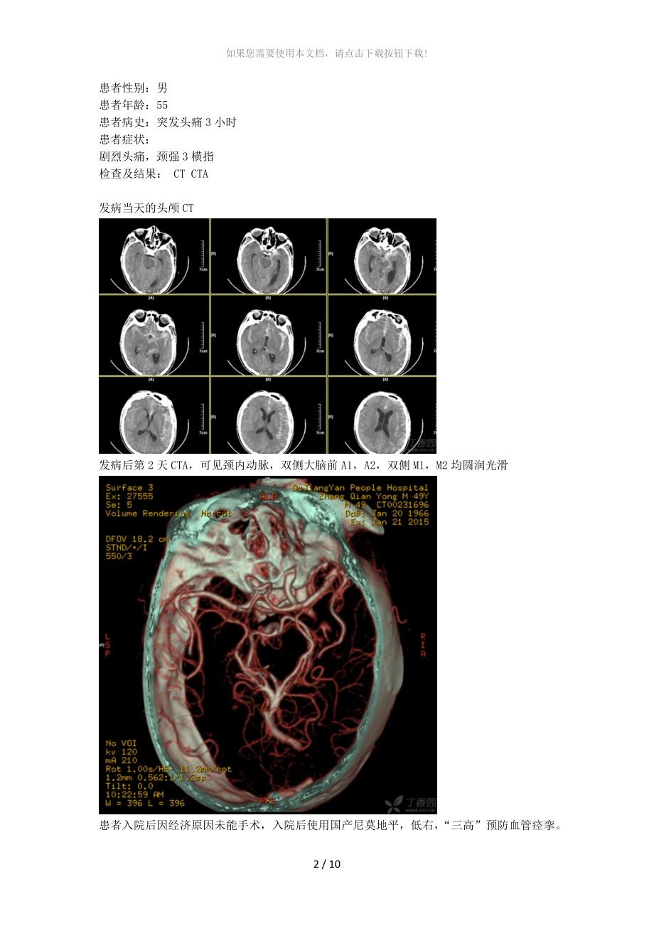 脑血管痉挛CVS_第1页