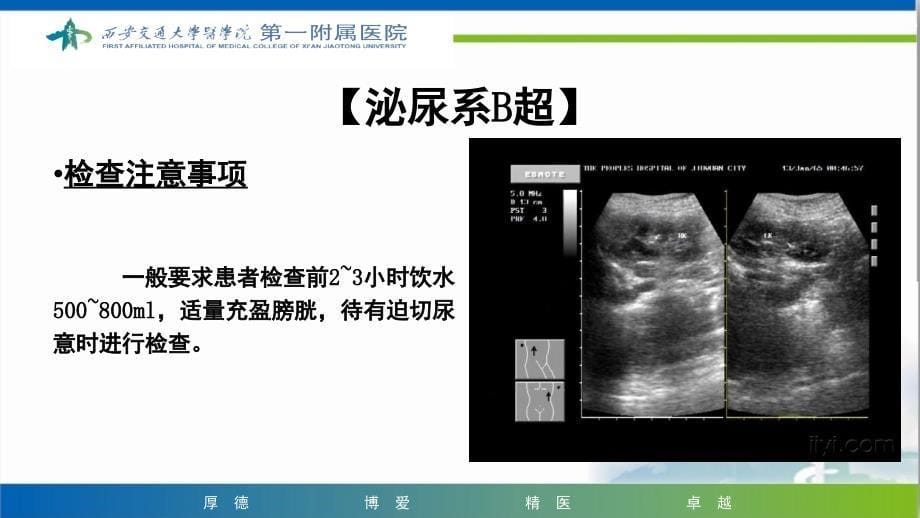 泌尿外科常见检查及其注意事项课堂PPT_第5页