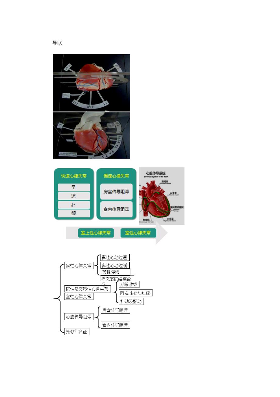 心律失常考点汇总_第4页