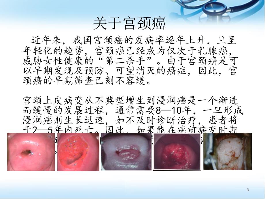 推荐精选HPV病毒介绍及检测意义_第3页