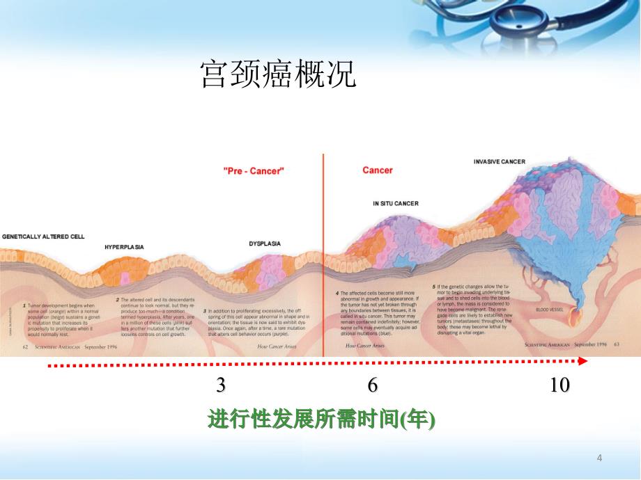 推荐精选HPV病毒介绍及检测意义_第4页