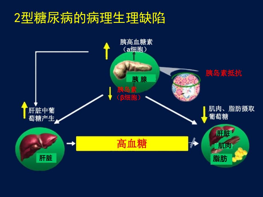 最新糖尿病口服药物治疗ppt课件精选文档_第4页