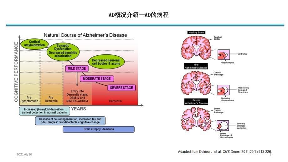 AD早期识别及诊治_第5页