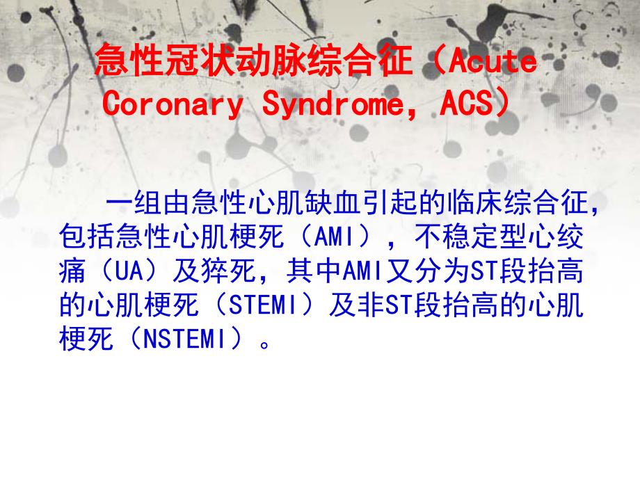 急性冠状动脉综合征 ppt课件_第2页