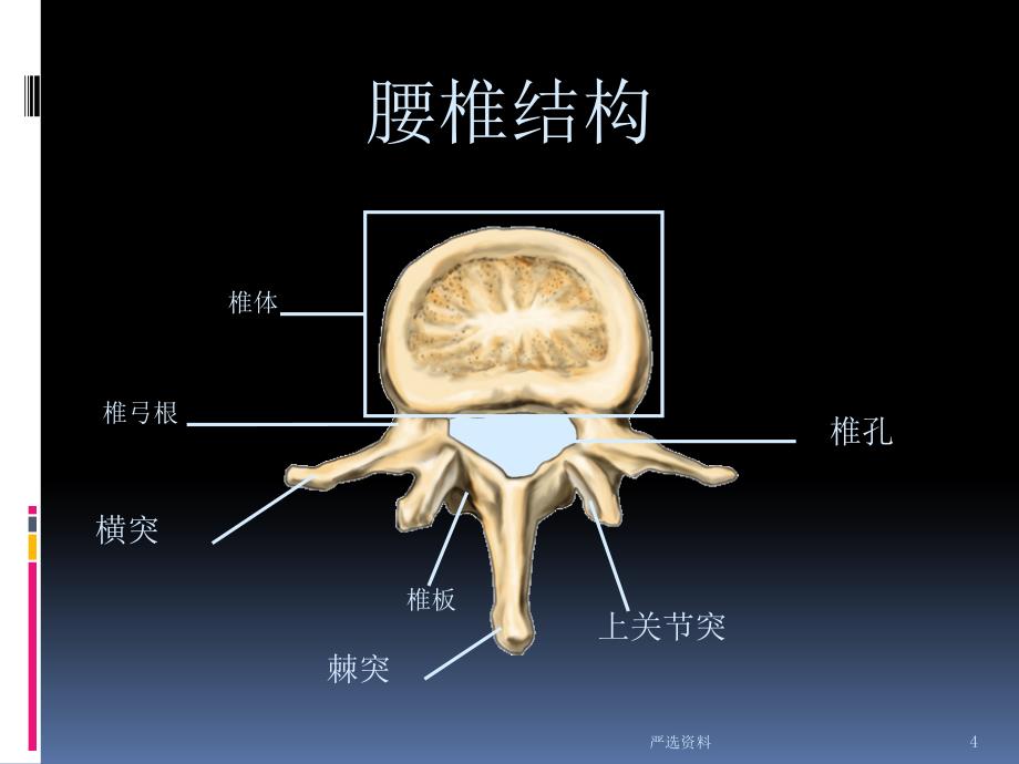 腰椎间盘突出影像学（行业荟萃）_第4页