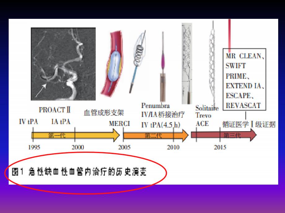 脑侧支循环评估ppt课件_第3页