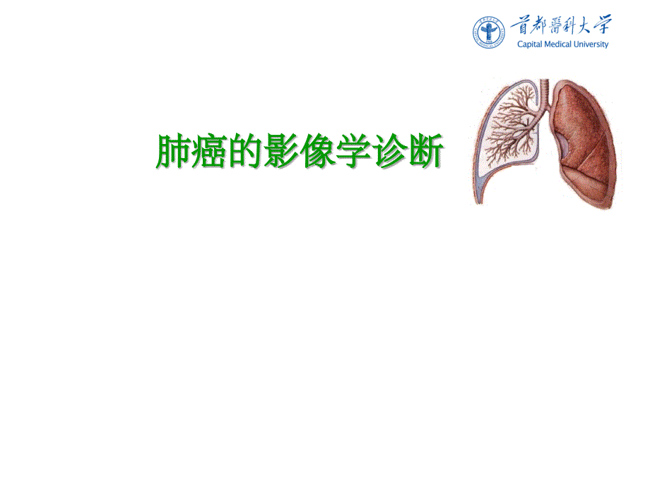 肺癌的影像学检查PPT课件_第1页