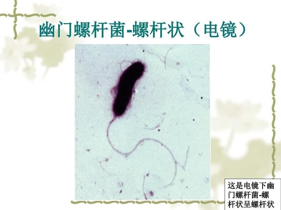 尿素13c呼气试验 ppt课件_第5页