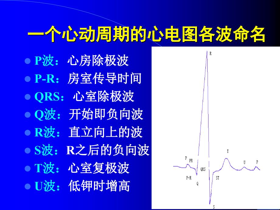 简要心电图分析_第4页