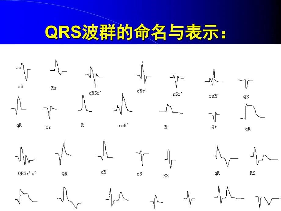 简要心电图分析_第5页