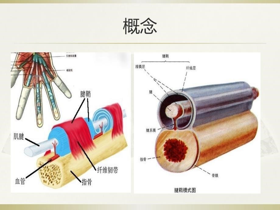 医学专题：狭窄性腱鞘炎(1)资料_第5页