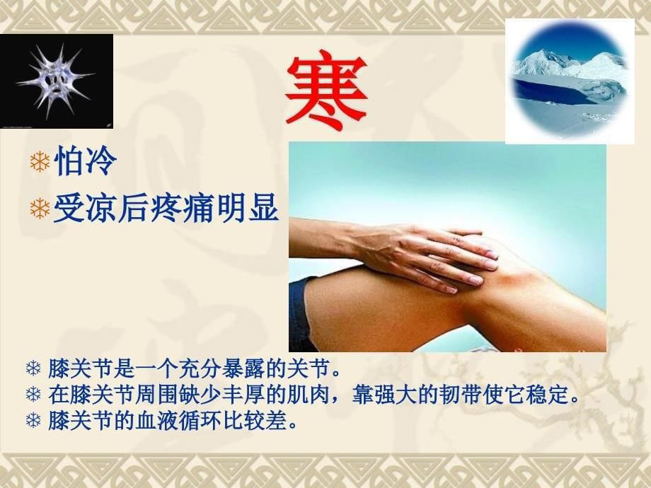 膝关节病健康教育.ppt_第5页