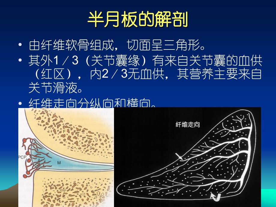 半月板损伤标准PPT课件_第3页