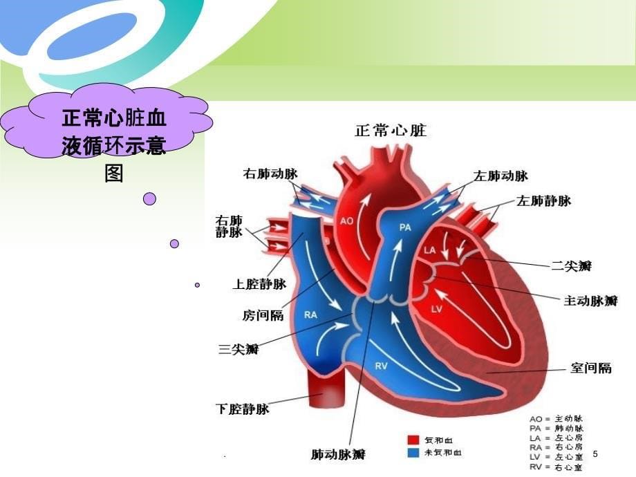 先天性心脏病外科治疗护理ppt课件_第5页