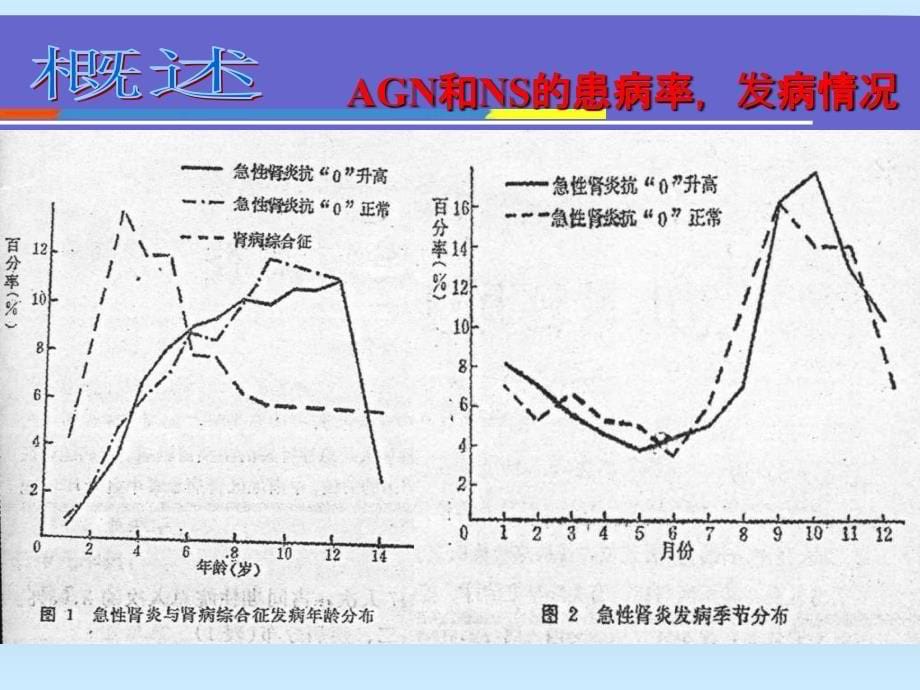 急性肾炎和肾病综合征_第5页