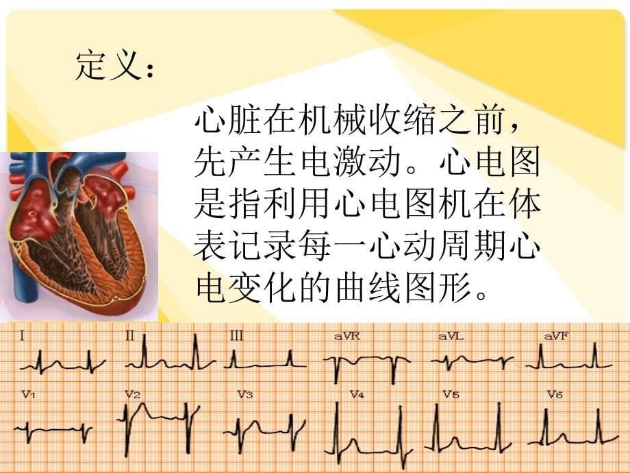 心电图的基础知识75841_第5页