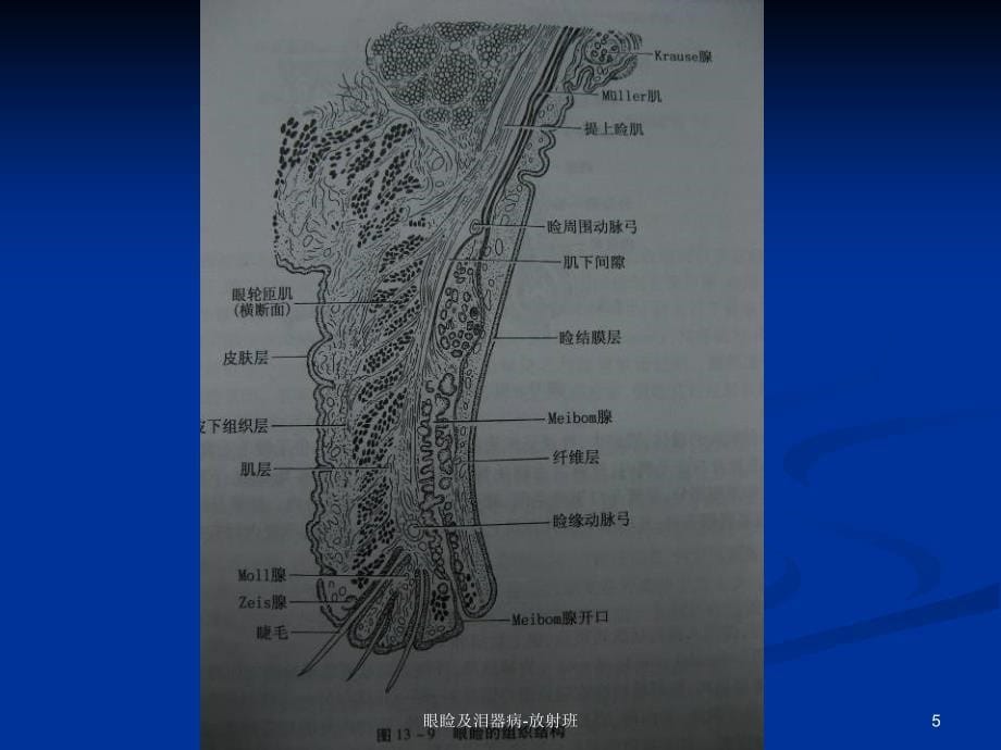 眼睑及泪器病-放射班ppt课件_第5页