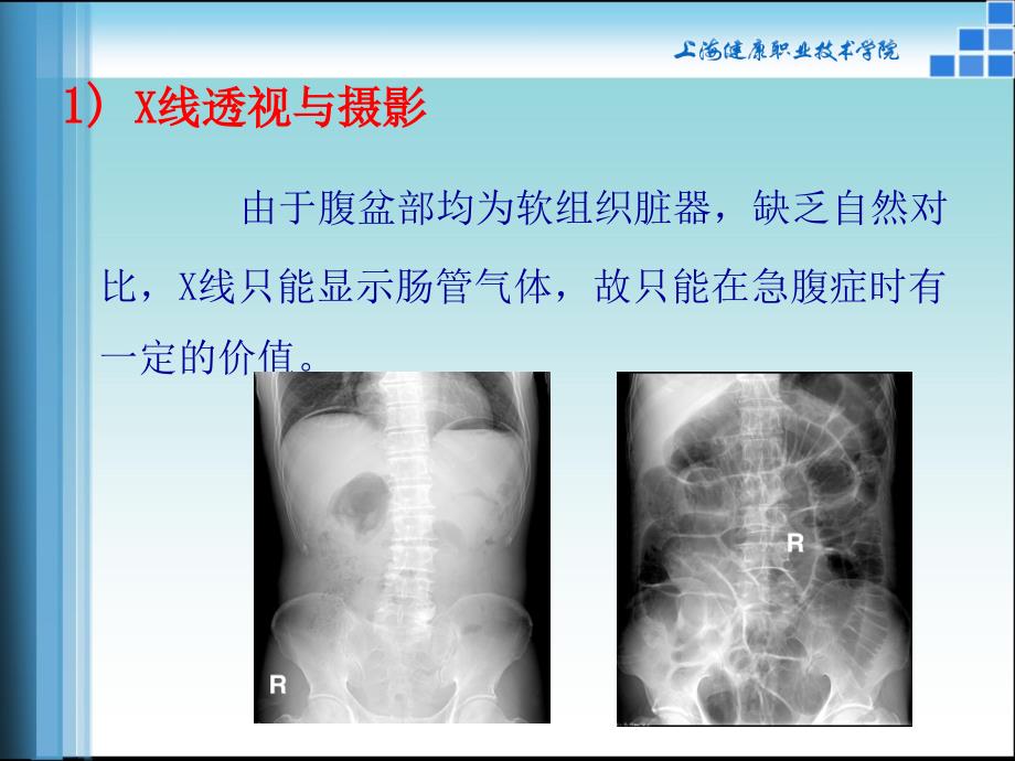 腹部影像诊断学PPT课件_第3页