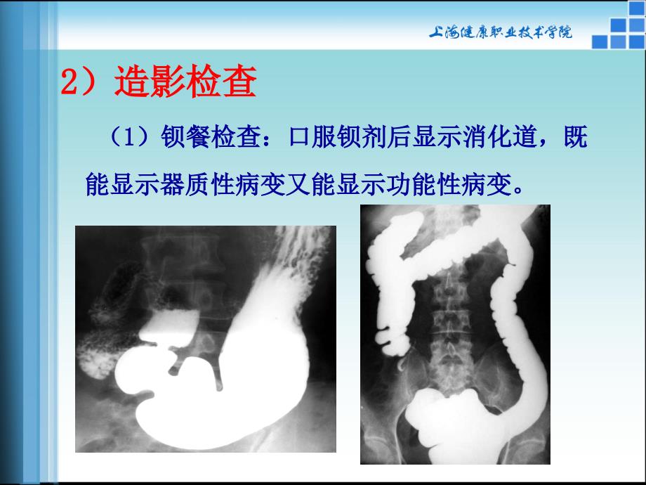 腹部影像诊断学PPT课件_第4页