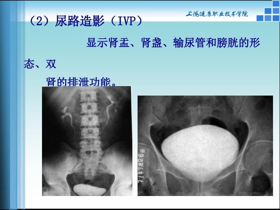 腹部影像诊断学PPT课件_第5页