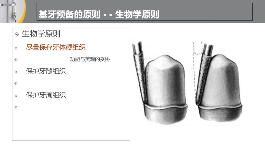 全冠的牙体预备_第4页