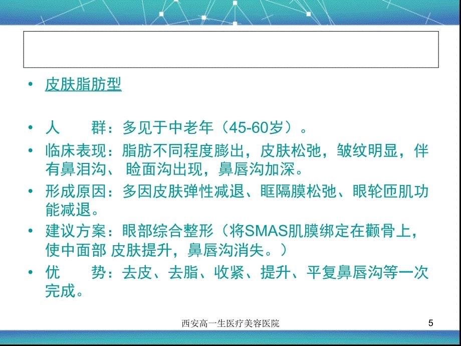 祛眼袋韩国午休眼袋释放术ppt课件_第5页